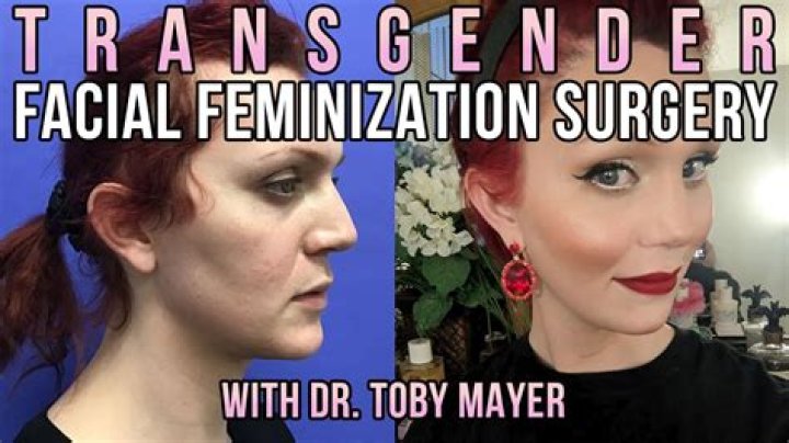 Is Tommy Dorfman Man Or Woman? Transgenger Before And After Photo