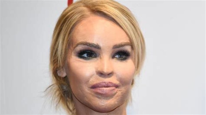 Katie Piper Children: Meet Penelope Diane And Belle Elizabeth Piper